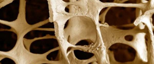 Conferència sobre l’osteoporosi